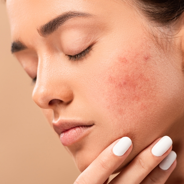 do serums help with spots